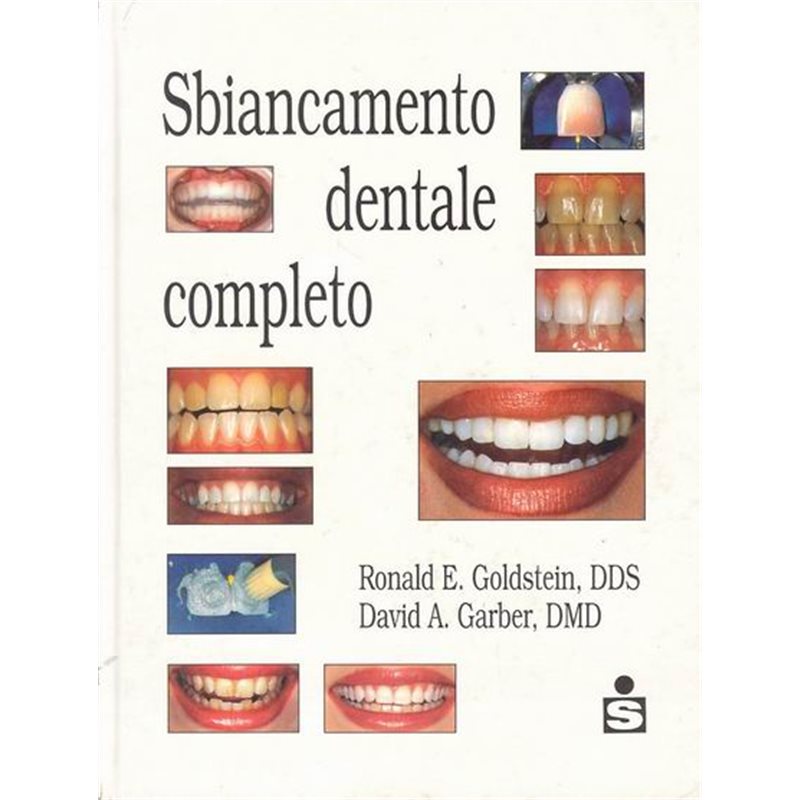 Sbiancamento dentale completo